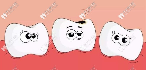吉爾巴赫全瓷牙的價(jià)格是怎么樣的