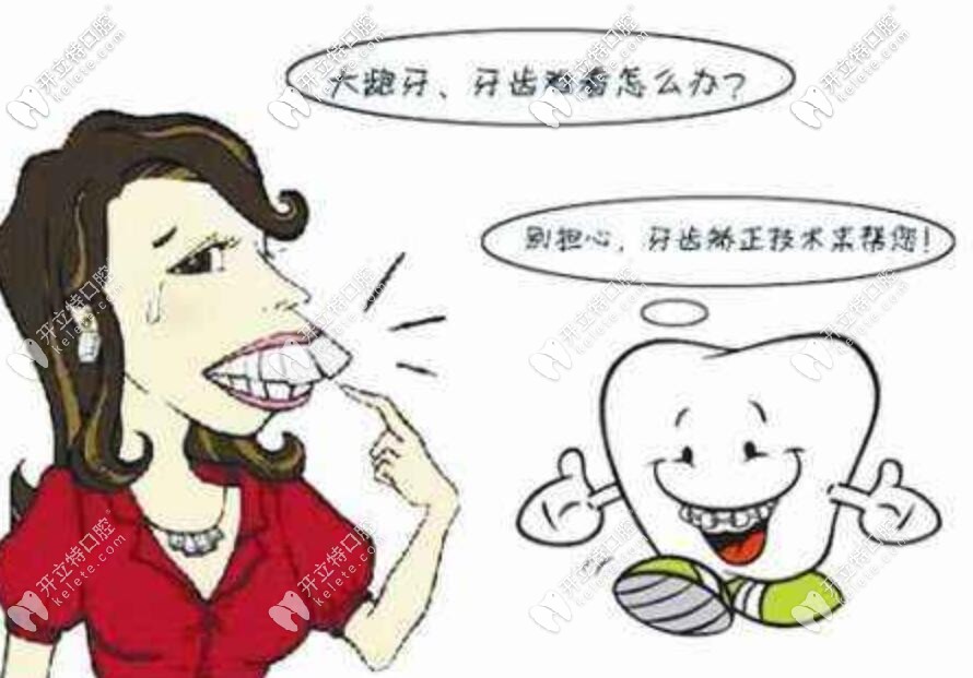 北京妹子說:因為窮,選擇了價格居中的金屬自鎖托槽矯正