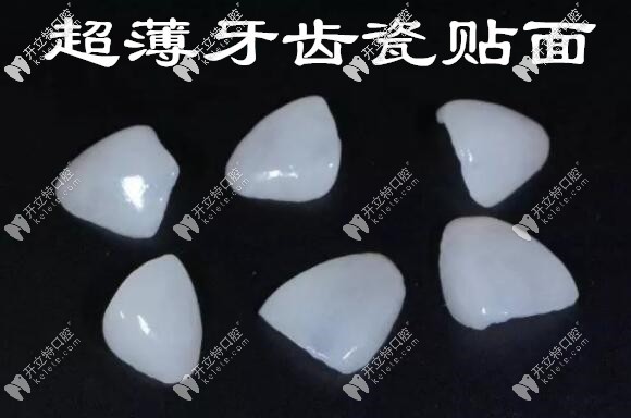 牙齒貼面會(huì)導(dǎo)致凸嘴嗎