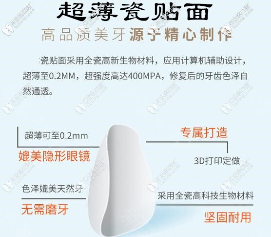 超薄牙齒瓷貼面優(yōu)勢(shì)