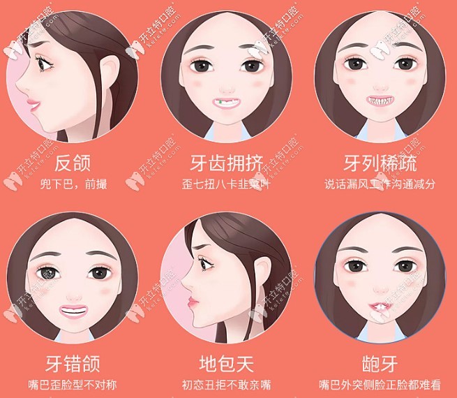 小妙招：教你1分鐘選出適合自己的正畸牙套