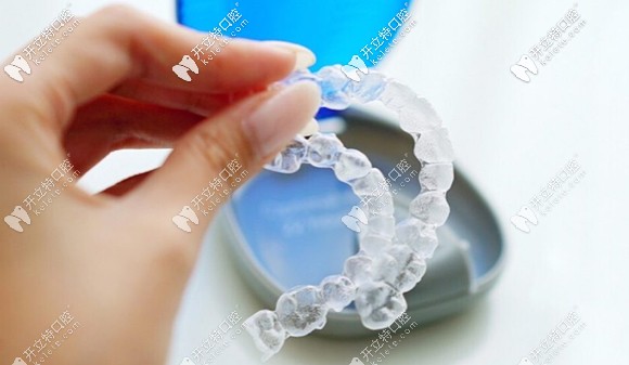 戴隱適美牙套的感受