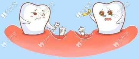 骨量少可以通過上頜竇提升技術(shù)改善