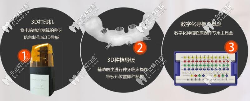 3d導(dǎo)板種植牙優(yōu)勢(shì)