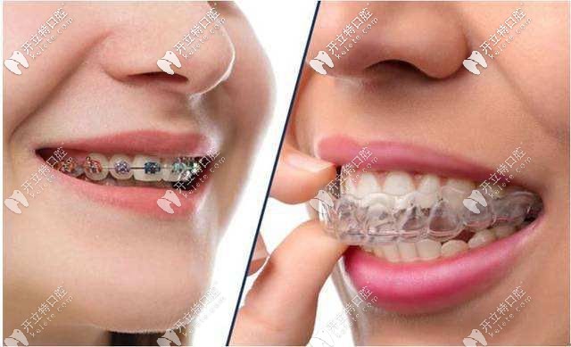 廣州瑞德口腔正畸特別活動(dòng)