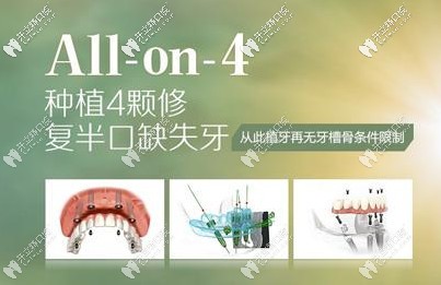 做All-on-4全口種植牙疼么