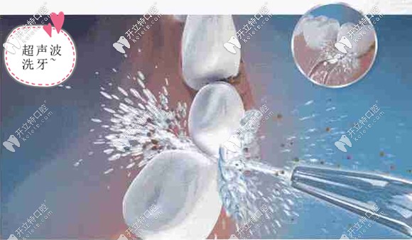 北京海淀區(qū)牙科門診焦麗麗醫(yī)生的直播內(nèi)容