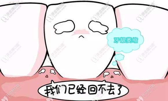 牙齦萎縮只能避免加重不能恢復正常