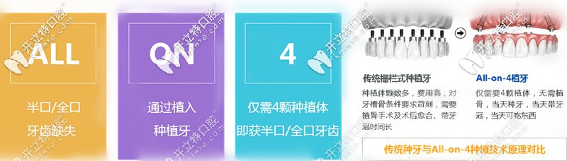 ALL-ON-4種植牙技術