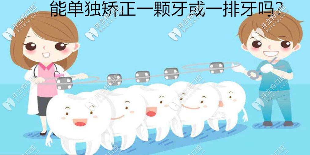 ?牙齒矯正能單獨(dú)矯正一顆歪牙或進(jìn)行一排牙齒正畸嗎？