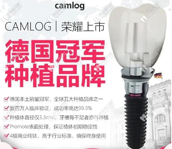 今天才知道了德國camlog種植體的價(jià)格，聽說質(zhì)量也不錯