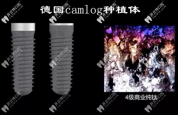 德國camlog種植體的材質
