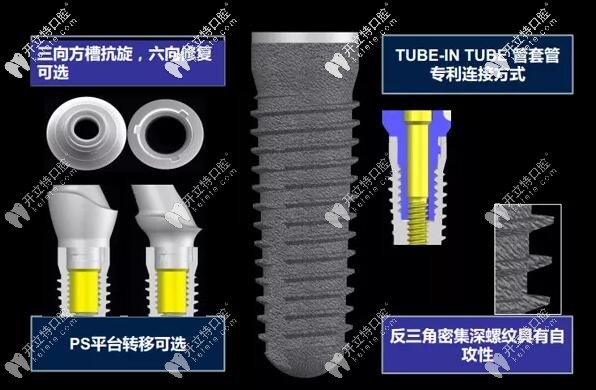 德國camlog種植牙的壽命