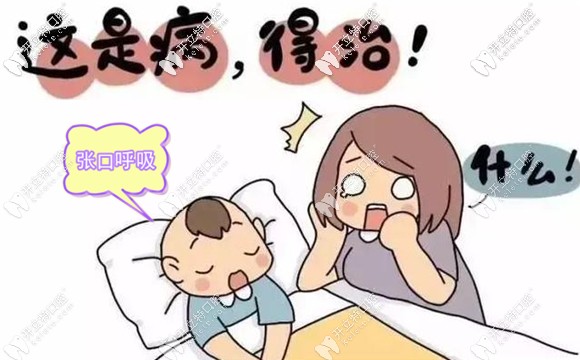 口呼吸會(huì)導(dǎo)致牙頜發(fā)育不良
