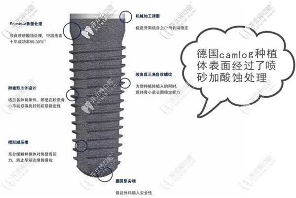 德國camlog種植體的質量如何