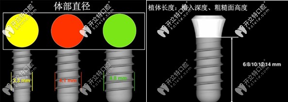 種植體的直徑和高度