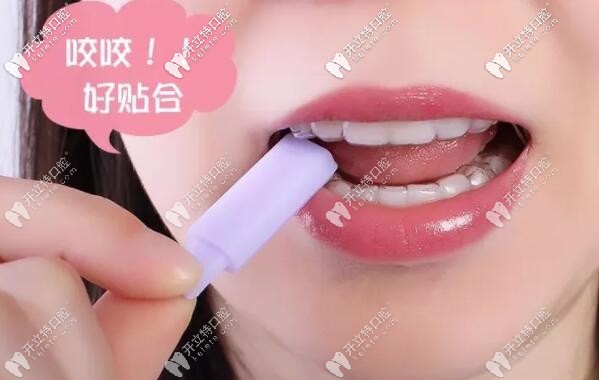 戴隱形牙套一定要咬咬膠 戴隱形牙套一定要咬咬膠