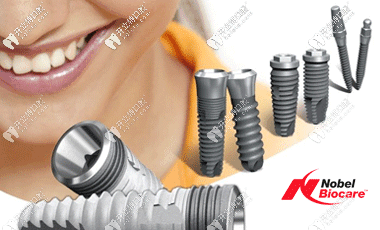 諾貝爾不同型號的植體