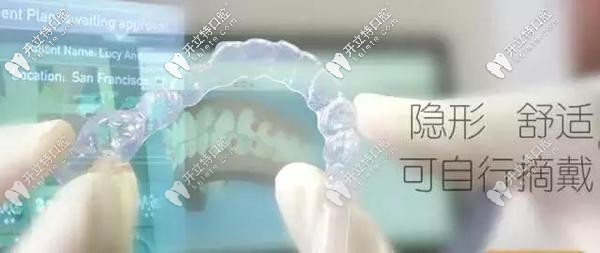 全隱形矯正器舒適美觀