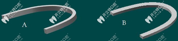 全同步帶狀弓矯正器的優(yōu)缺點