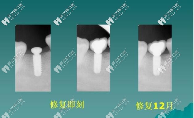 即刻修復(fù)<span style=