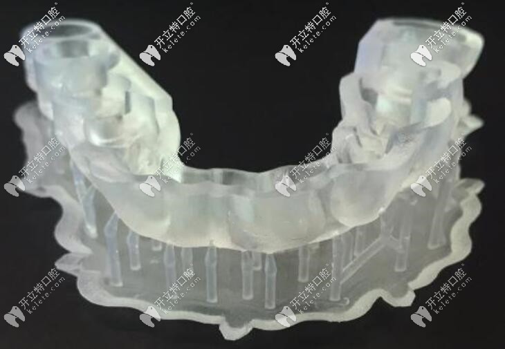 做半口種植技術使用的導板
