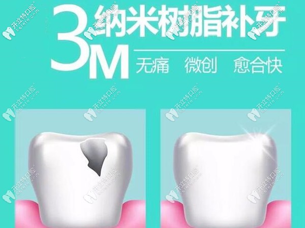 母親節(jié)西安美奧口腔樹脂補牙免費