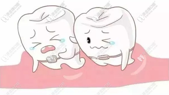 什么情況適合半口矯正呢？