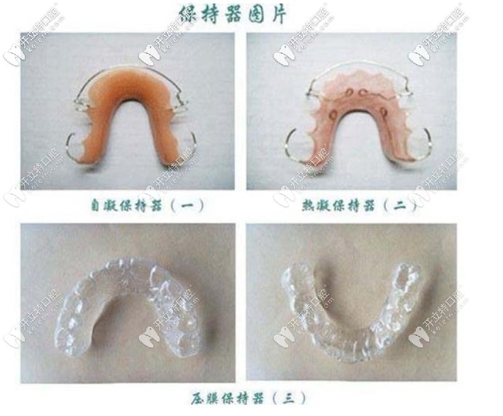 網(wǎng)上找的保持器圖片，我戴的是透明的保持器