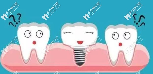 面診西安牙科發(fā)現(xiàn)歐美皓圣種植牙與韓國登騰價格區(qū)別不大