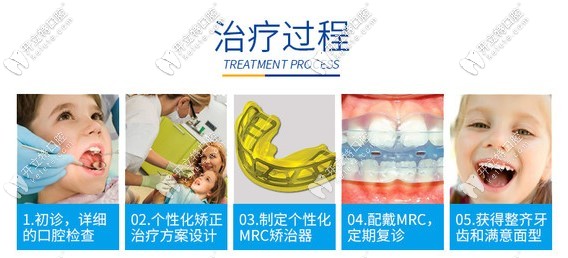 兒童mrc矯正治療過(guò)程