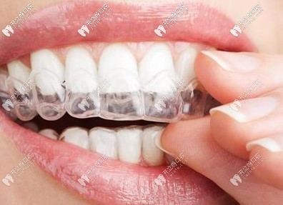 長(zhǎng)沙美奧口腔隱形矯正