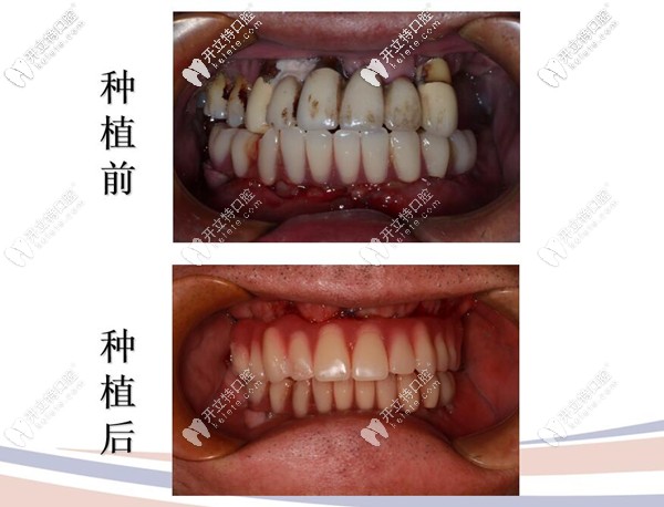 即刻修復(fù)案例 即刻修復(fù)案例