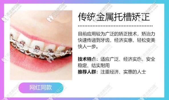 傳統(tǒng)金屬托槽矯正優(yōu)點(diǎn)