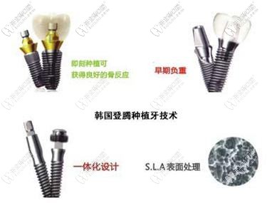 登騰種植體的設計