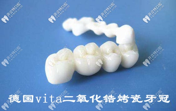 德國vita二氧化鋯烤瓷牙冠