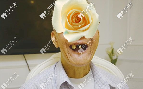 老伯做全口種植牙前的口內(nèi)照 老伯做全口種植牙前的口內(nèi)照