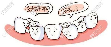 兒童牙列不齊可以矯正嗎