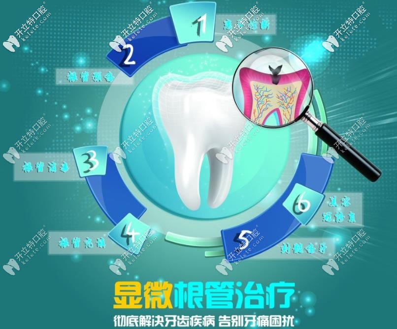 顯微根管治療優(yōu)勢(shì)