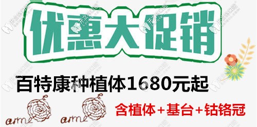 百特康種植體的價格