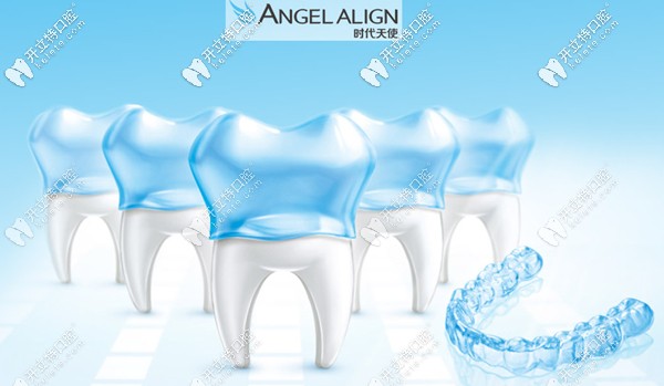 時(shí)代天使隱形矯正的價(jià)格只要13800元起