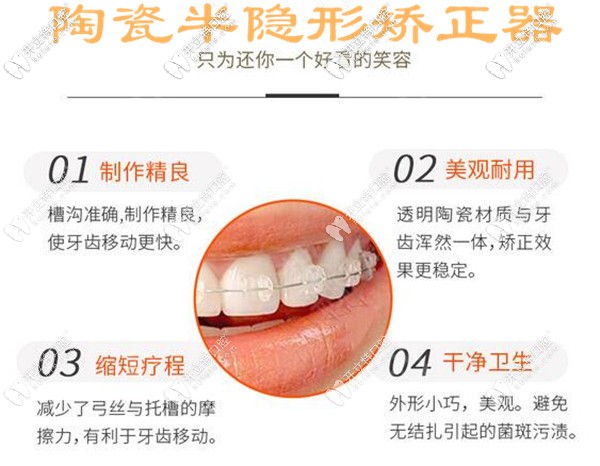 陶瓷半隱形矯正器