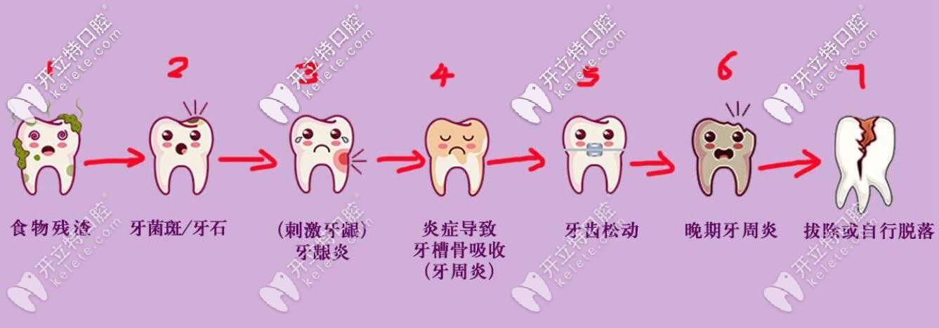 快看西安牙科收費(fèi)價(jià)目表,那些牙疼拖延不看牙的人不淡定了