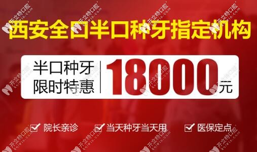 西安中諾口腔半口種植牙價(jià)格