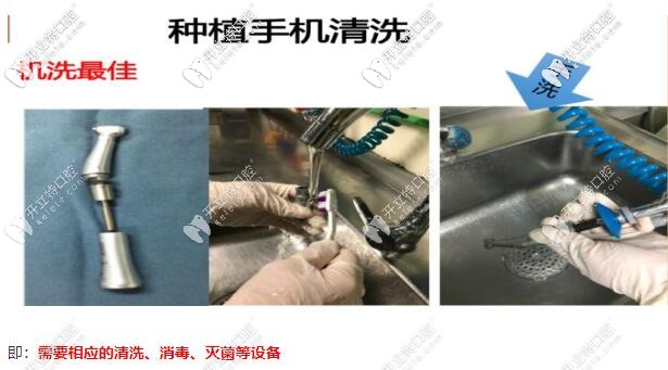 種植牙手術(shù)預(yù)防感染