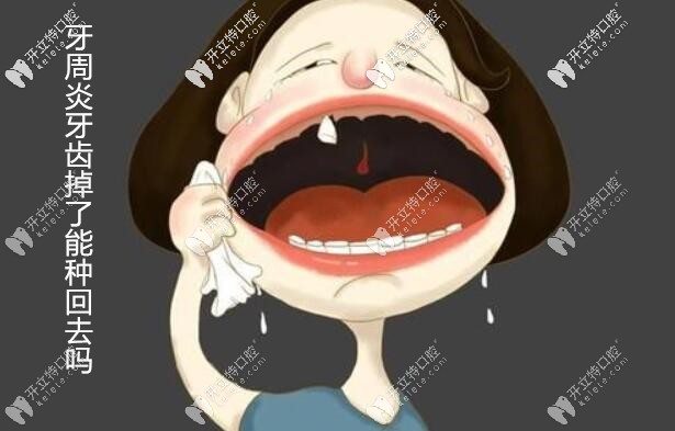 不是所有的牙齒掉了都能種回去的