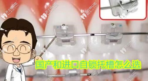 國產(chǎn)和進口自鎖托槽區(qū)別