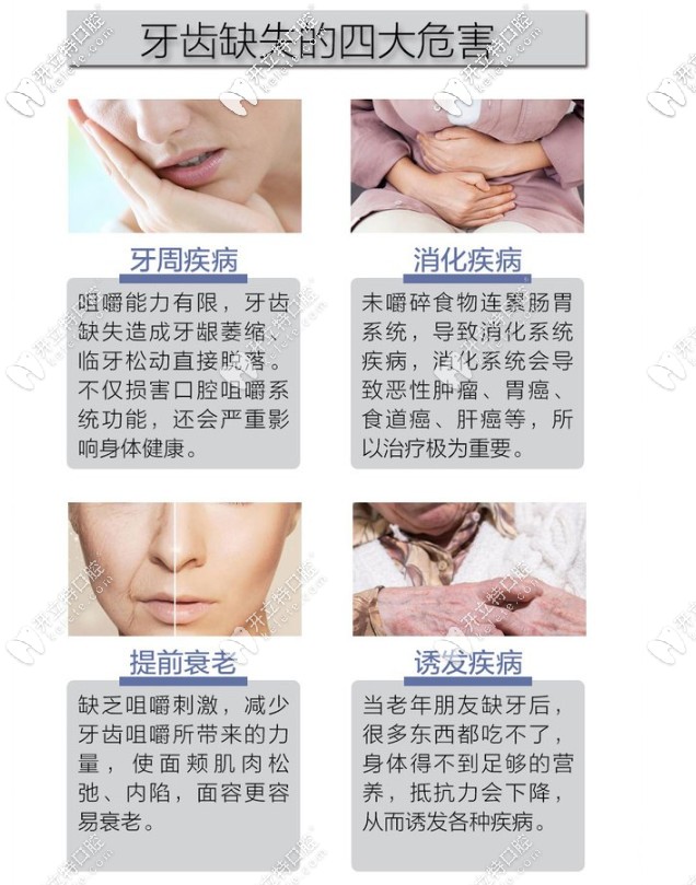 牙齒缺失的危害