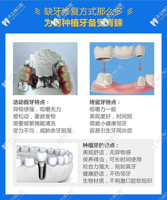 為什么選擇種植牙