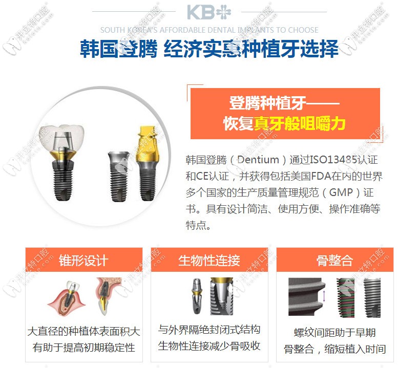 韓國登騰種植牙的優(yōu)勢(shì)
